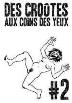 Des cro�tes aux coins des yeux 
